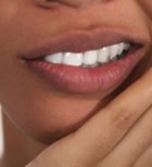  השתלת שיניים בהרדמה מלאה: כל היתרונות-תמונה